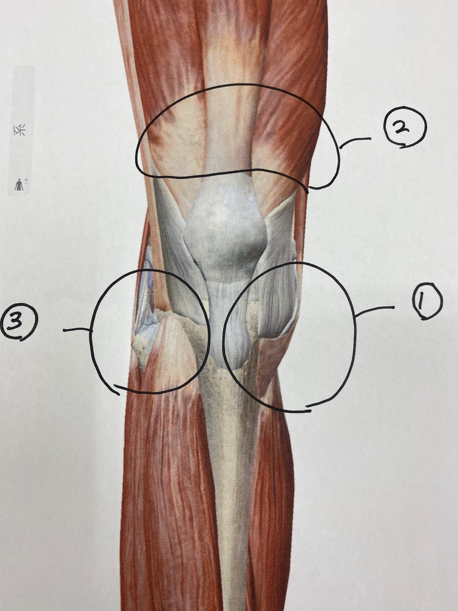 膝 横 の 腫れ