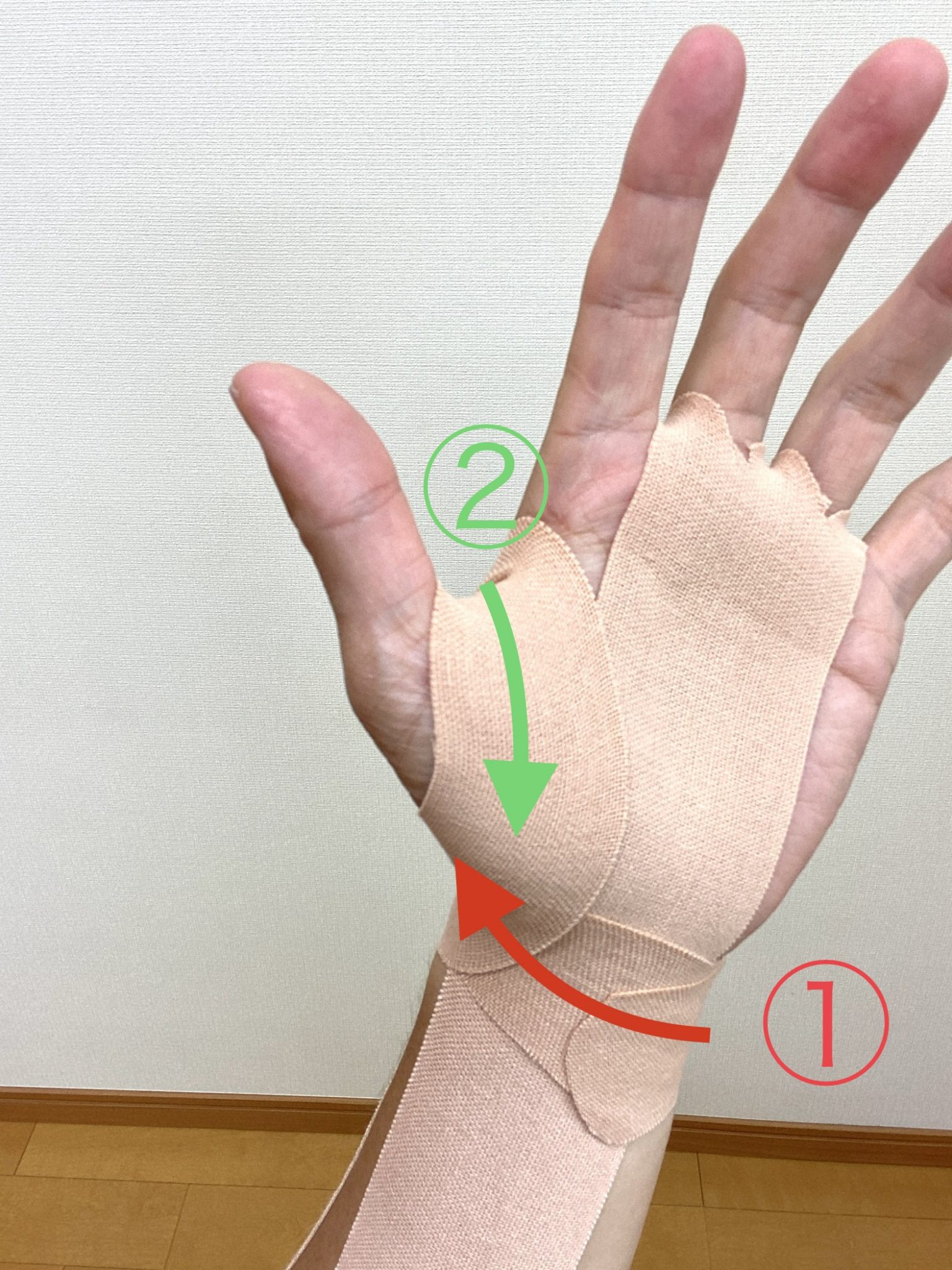 手根管症候群の治療は手術が最善？体験談からの読み解きと手術失敗のリスク 白石市で整体なら白石接骨院いとうへ！3万人以上を施術し紹介率95％！