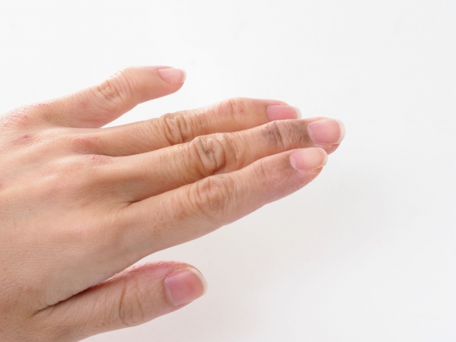 突き指と骨折の見分け方 症状の違いや治療期間の目安を解説 白石市で整体なら白石接骨院いとうへ ３万人以上を施術し紹介率95