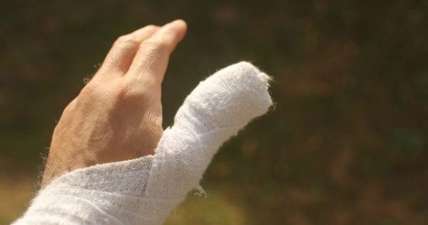 親指の突き指について。原因や症状、病院に行く目安などを詳しく解説！